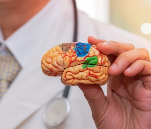 O Comportamento Humano na Logística: Como a Neurologística Pode Redefinir os Processos